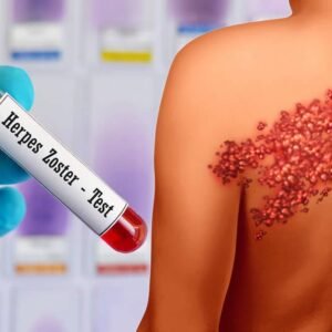Herpes Type 1 & 2