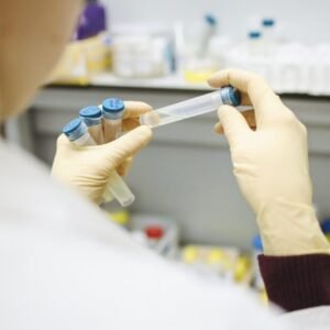 Urine Alcohol With 5 Panel Drug Test