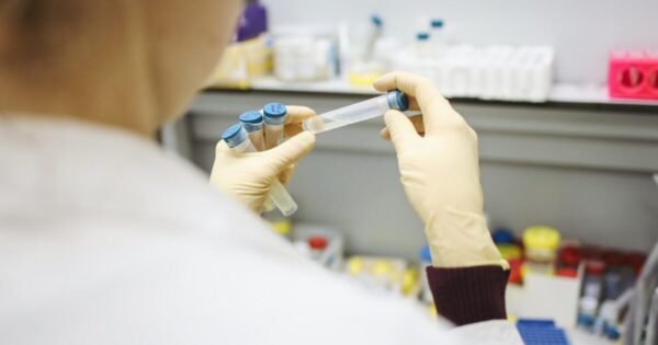 Urine Alcohol With 5 Panel Drug Test