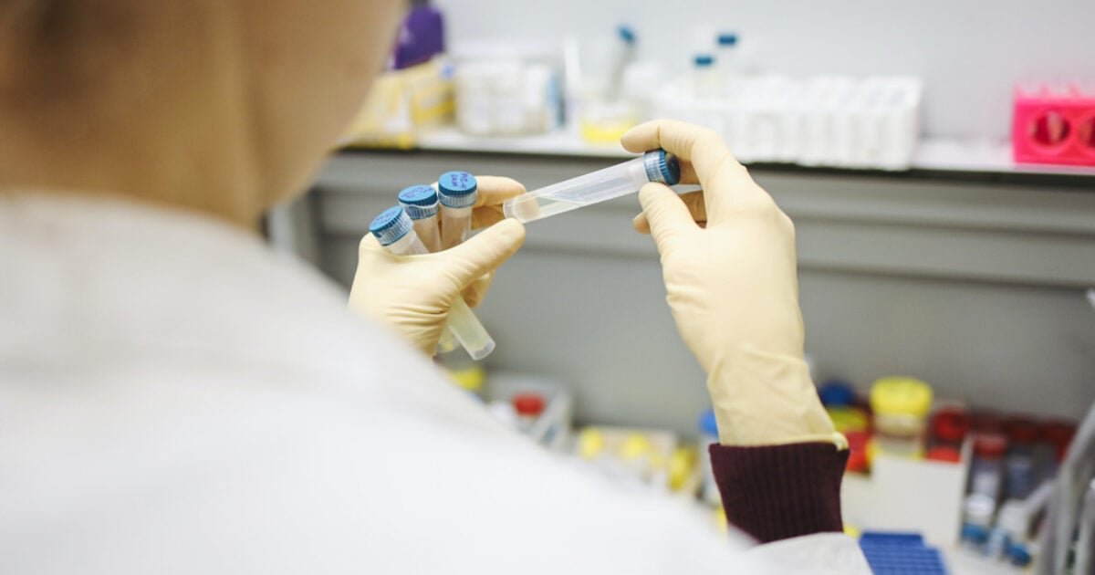 Urine Alcohol With 5 Panel Drug Test