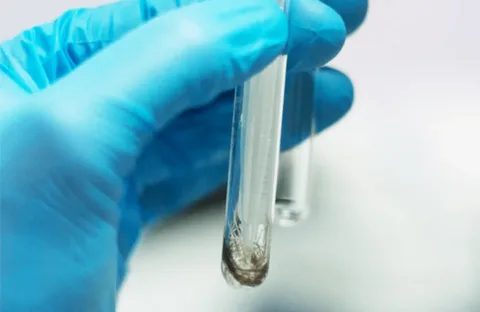 Alcohol ETG – Hair Test
