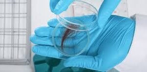 Hair Drug Test – 17 Panel