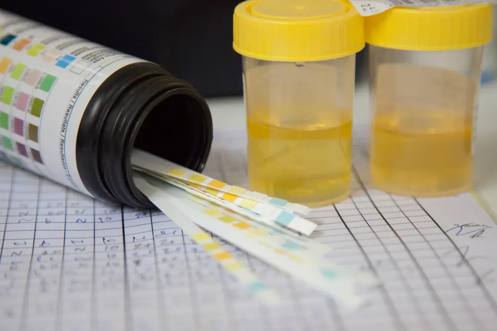 5 Panel With Expanded Opiates Urine Drug Test